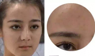 额头长痘痘是什么原因 额头长痘痘是什么原因怎么调理女性