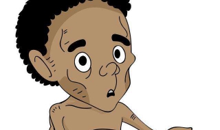 营养不良的症状 营养不良的症状有哪些表现