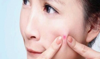 脸上长痘痘怎么调理 脸部长痘如何调理