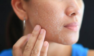 脸上毛孔长毛怎么办 脸上毛孔长毛毛是什么原因