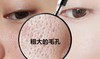 皮肤毛孔大怎么办（皮肤毛孔粗大怎么保养）