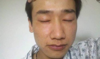 春季皮肤干燥怎么办 春季皮肤干燥是什么原因引起的