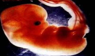 为什么会死胎（为什么会死胎什么原因造成的）