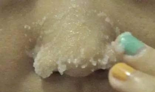 鼻子黑头怎么办 怎样去掉鼻子上的黑头