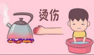 轻微烫伤怎么办 手指轻微烫伤怎么办