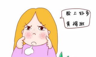 面部黄褐斑怎么办 面部黄褐斑图片