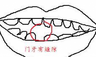 门牙中间有缝怎么办 小孩上门牙中间有缝怎么办