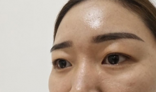 下眼皮松弛怎么办 下眼皮松弛如何紧致