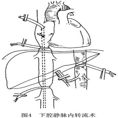 失血性贫血怎么回事以及处理 失血引起的贫血怎么办
