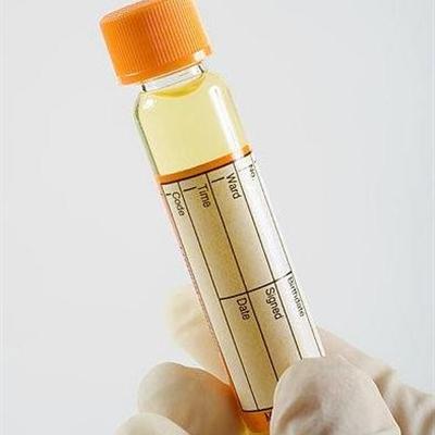 外伤性血尿是什么（外伤引起的血尿）