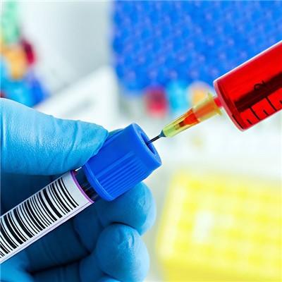 献血能查出艾滋病或者HIV病毒吗 献血会查hiv病毒吗