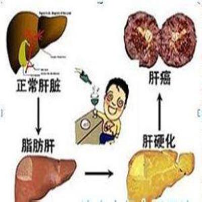 脂肪肝的早期症状是什么呢（脂肪肝的早期症状和前兆）