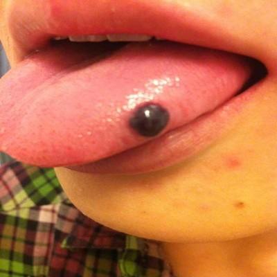 嘴巴里面起血泡怎么回事（嘴巴里面起血泡怎么回事儿）