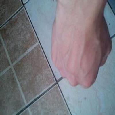手背血管突起怎么办（手背血管凸起怎么回事）