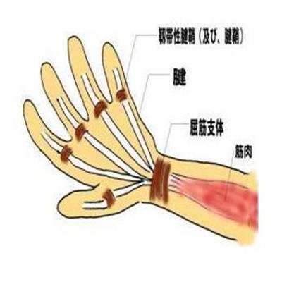 腱鞘炎怎么办 大拇指腱鞘炎怎么办