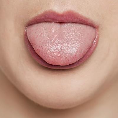 口苦和口臭怎么办 口苦口臭怎么办该怎样消除
