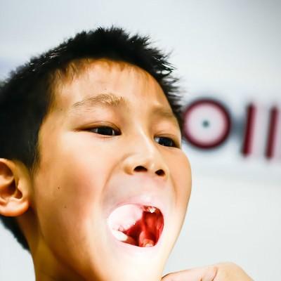 口腔溃疡缺乏什么维生素 口角炎口腔溃疡缺乏什么维生素