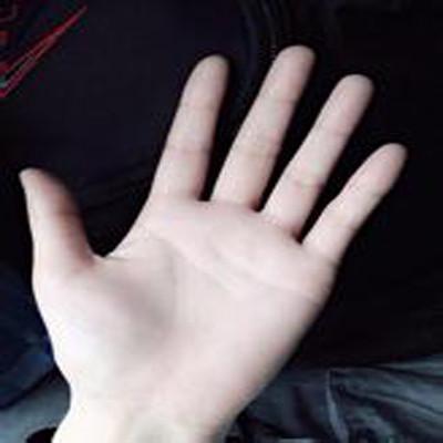 手总是出汗怎么办 写作业手总是出汗怎么办
