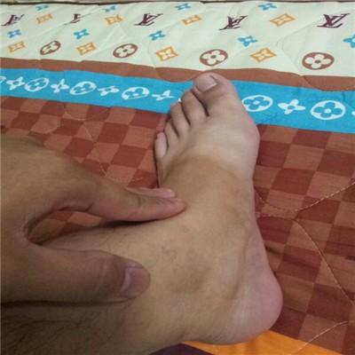 脚裸肿是什么原因 脚裸肿是什么原因 女性