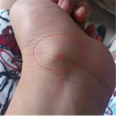 手腕骨头突出怎么办 手腕骨头突出来怎么办