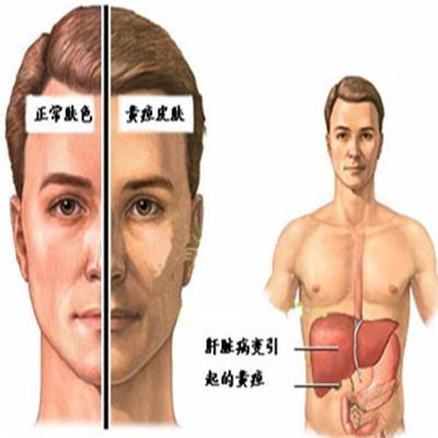 老祖宗的养肝护肾方 养肝护肾药方