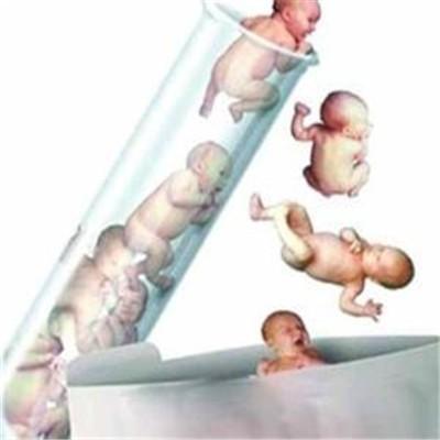 试管婴儿的条件是什么 试管有什么条件