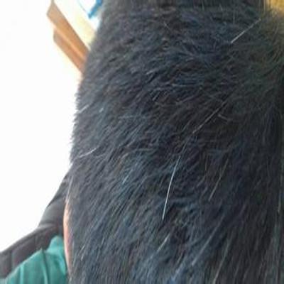 长白头发怎么办 青春期长白头发怎么办