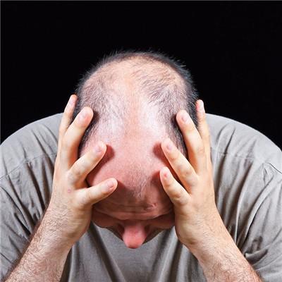 脱发后怎样使头发再生 脱发后怎样使头发再生长快