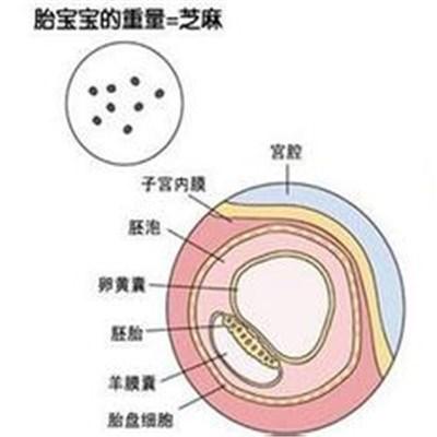怀孕染色体检查什么 怀孕染色体检查什么时候