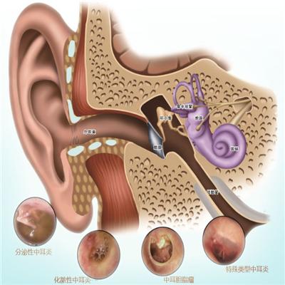 上耳根疼是怎么回事 上耳根疼是怎么回事儿