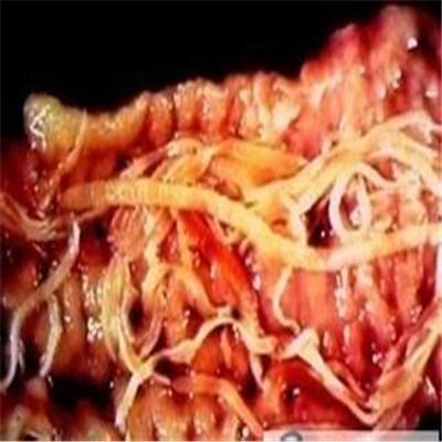怎样检查肠道寄生虫（怎样检查肠道寄生虫病）