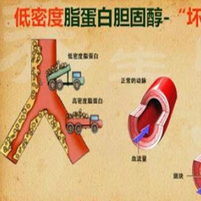 低密度脂蛋白胆固醇偏高怎么办 低密度脂蛋白胆固醇偏高怎么办?