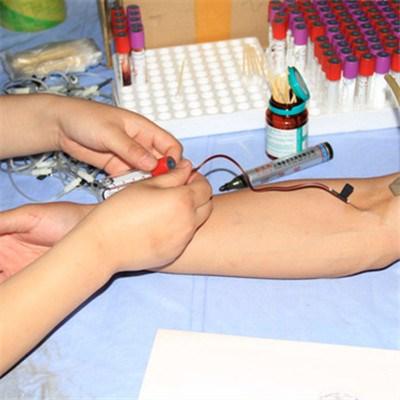 静脉曲张手术后注意事项（左侧精索静脉曲张手术后注意事项）