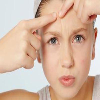 额头上长痘痘怎么调理好 额头长痘痘应该怎么调理才能好