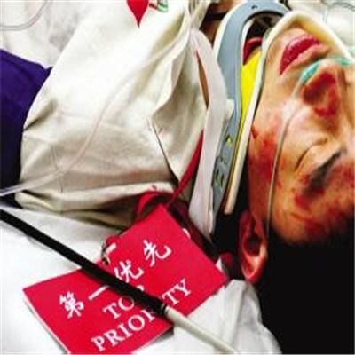 肾衰竭的早期症状是什么 肾衰竭的早期症状是什么样