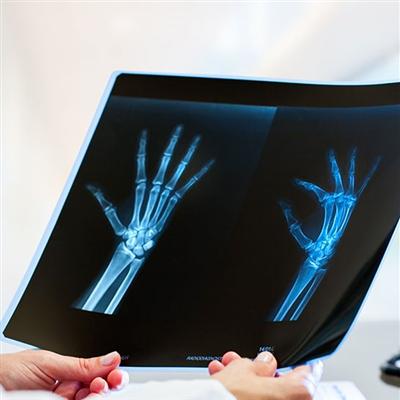 股骨头坏死能治好吗（早期股骨头坏死能治好吗）