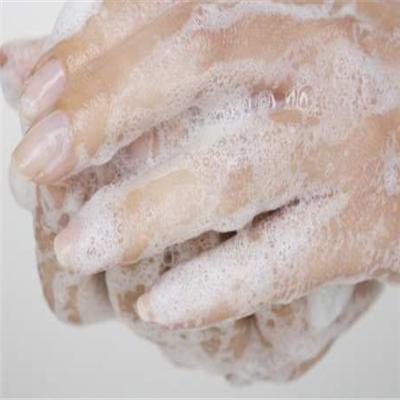 被狗咬了出血了伤口不消肿怎么办（被小狗咬了没出血肿了怎么办）