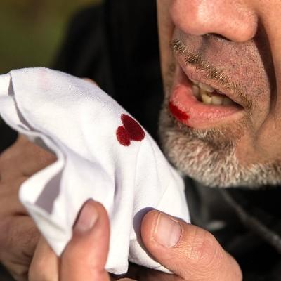 肺结核会经常容易饿吗（肺结核会经常感到饿吗）