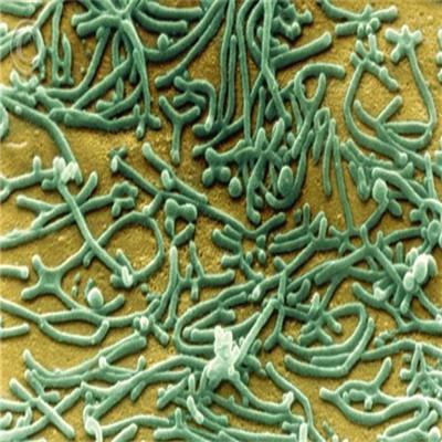 得了支原体能根治吗 支原体能治得好吗