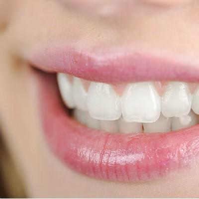 洗牙一次多少钱（超声波洗牙一次多少钱）