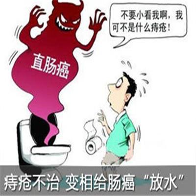 痔疮和直肠癌的区别是什么 痔疮与直肠癌的区别是什么