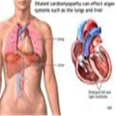 冠心病有什么症状（冠心病有什么症状和危害）