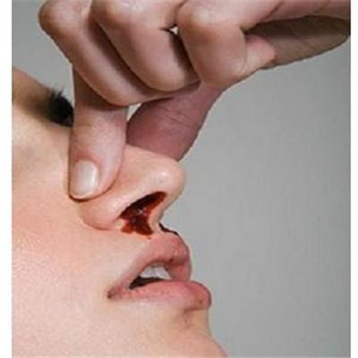 经常流鼻血是怎么回事 年纪大了经常流鼻血是什么原因