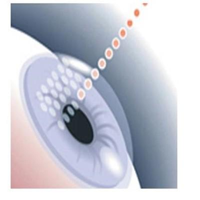 超声波去眼袋多少钱 超声波去眼袋多少钱啊