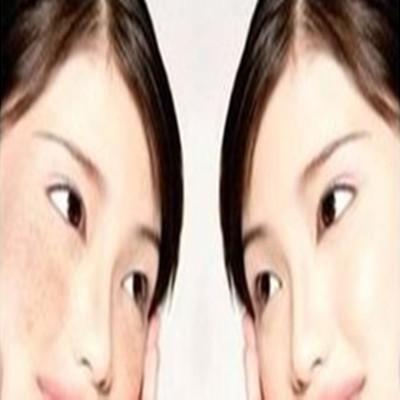 激光祛斑的利弊是什么（激光祛斑的利弊是什么呢）