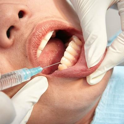 治口腔溃疡的药有什么呢（治口腔溃疡的药是什么）