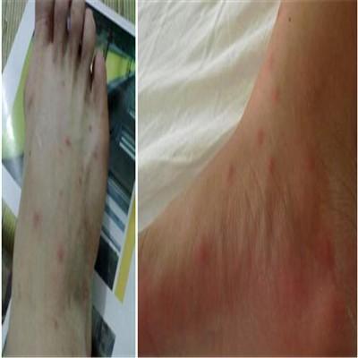 脚底发白很臭怎么办（脚底发白很臭怎么办用什么药）