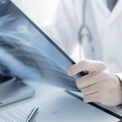 肝功能异常怎么办 免疫治疗肝功能异常怎么办