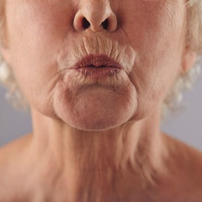 胆囊息肉的症状 胆囊息肉的症状是哪里疼