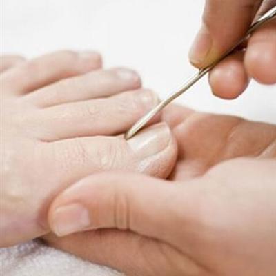 灰指甲怎么根治 灰指甲怎么根治简单有效的方法图片